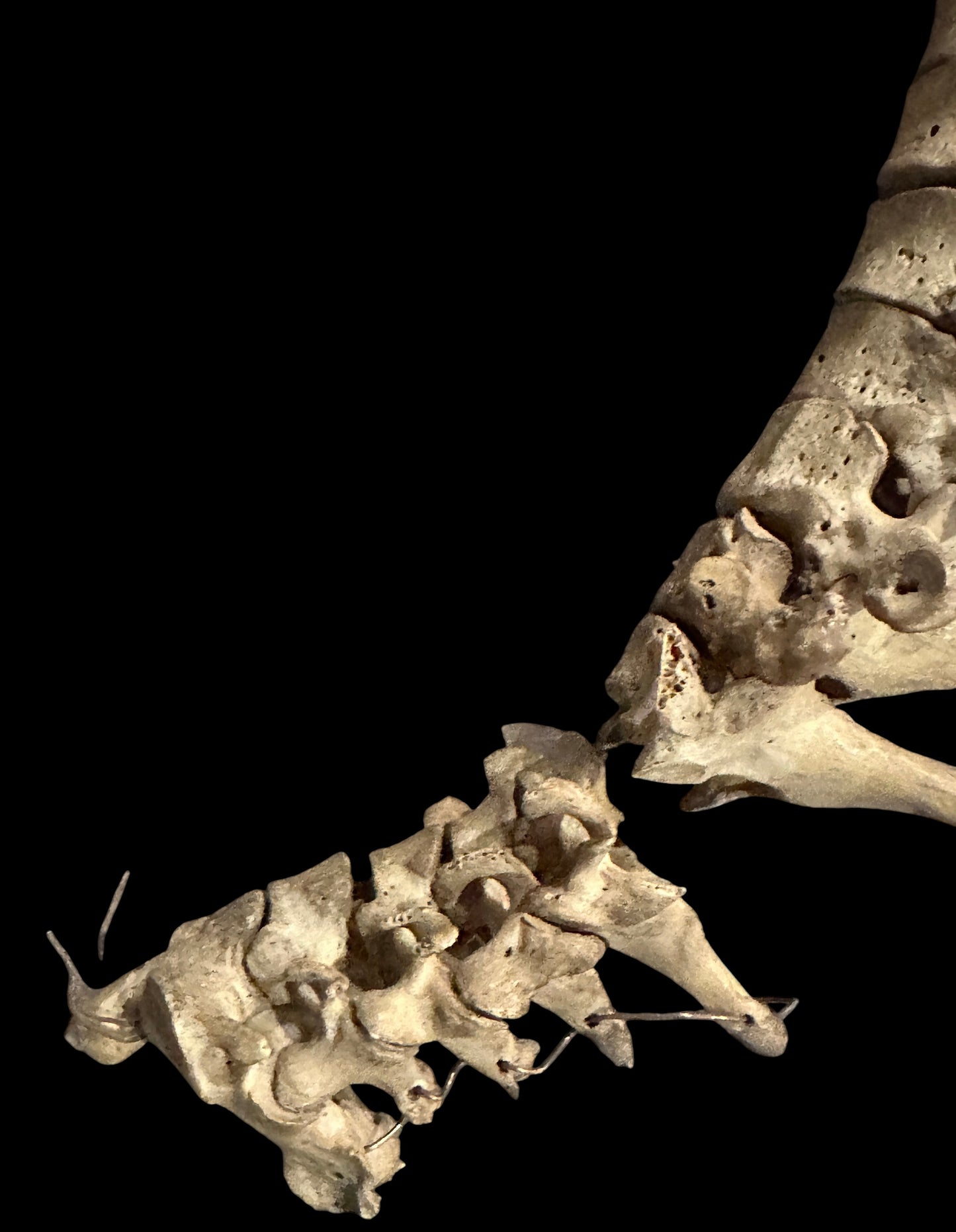 Human Vertabrae Column
