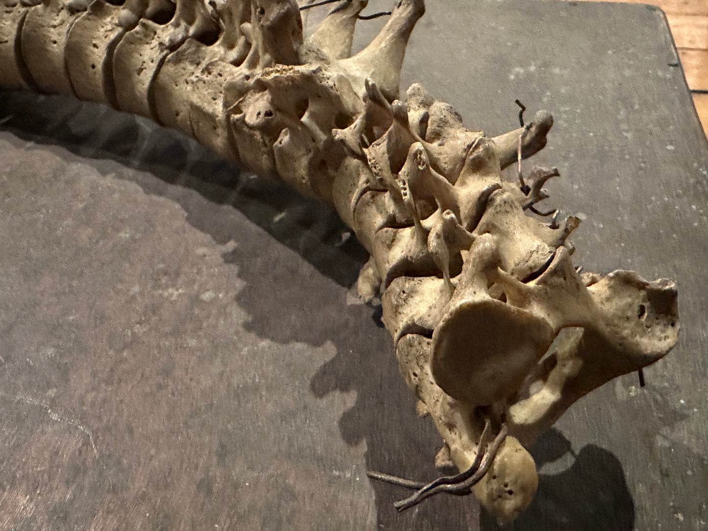 Human Vertabrae Column