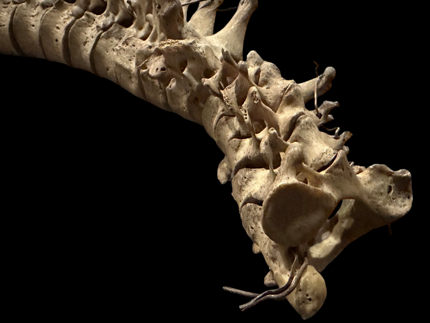Human Vertabrae Column
