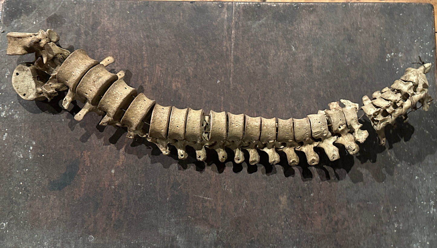 Human Vertabrae Column
