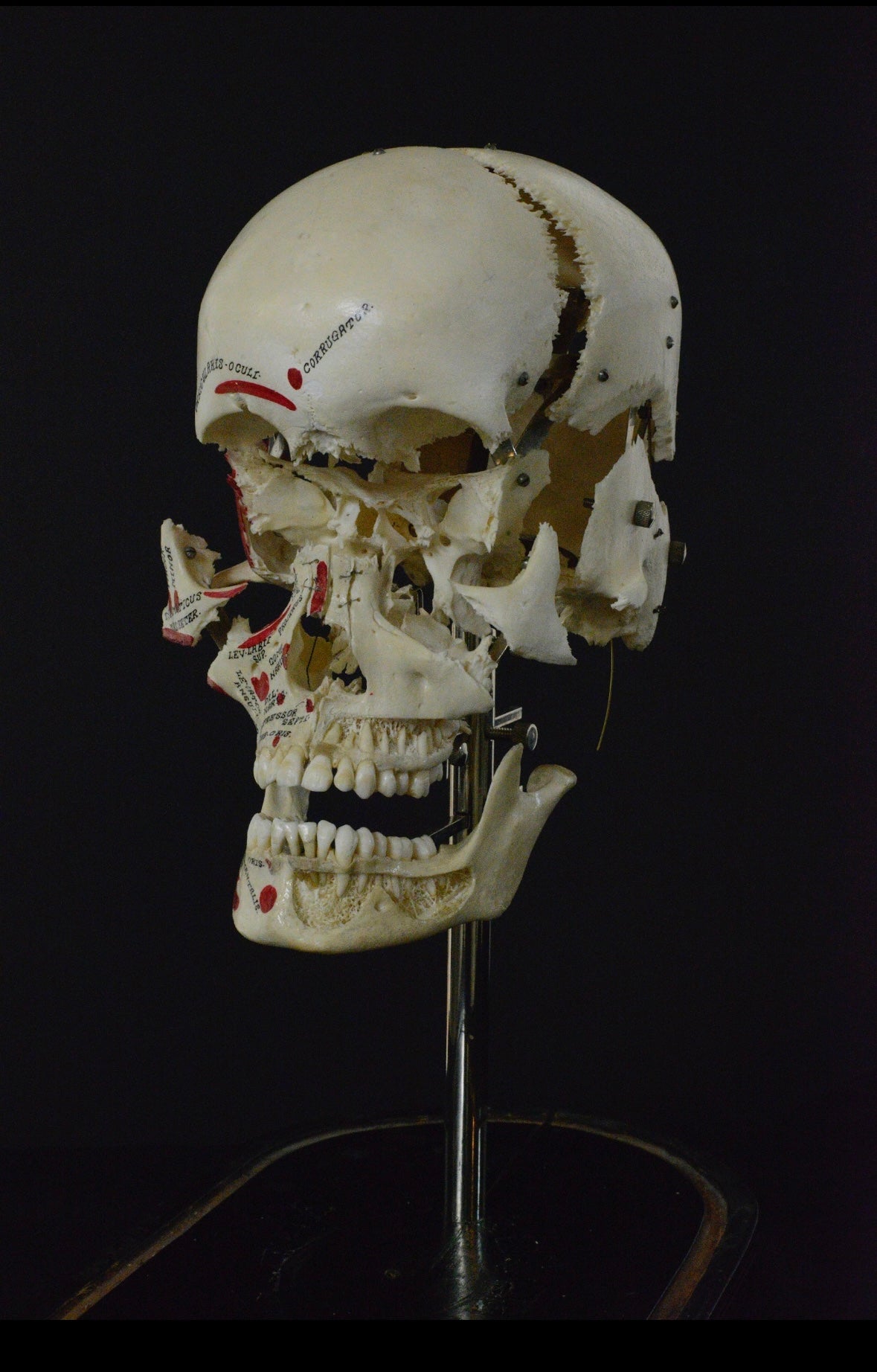 Authentic Exploding Skull: Beauchene Skull