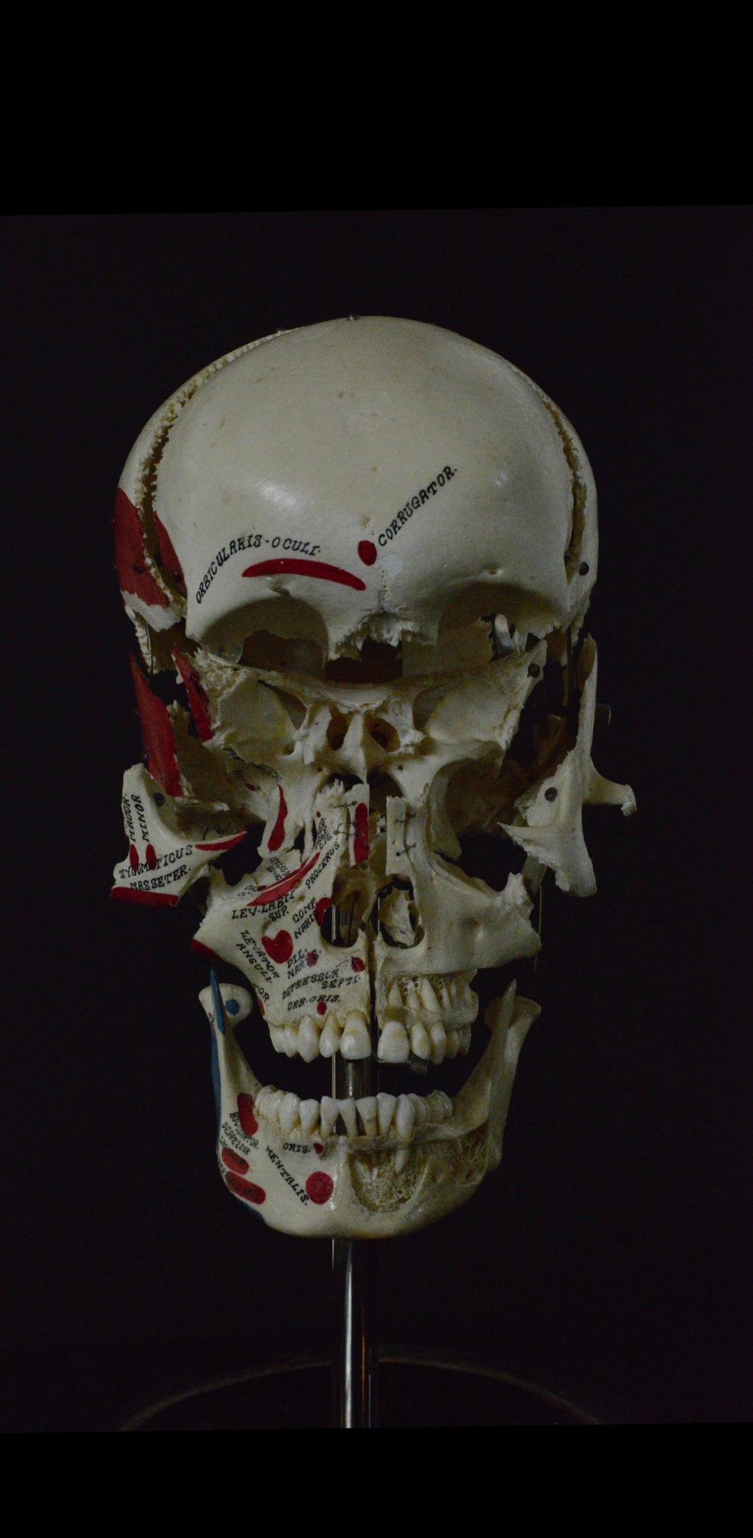 Authentic Exploding Skull: Beauchene Skull