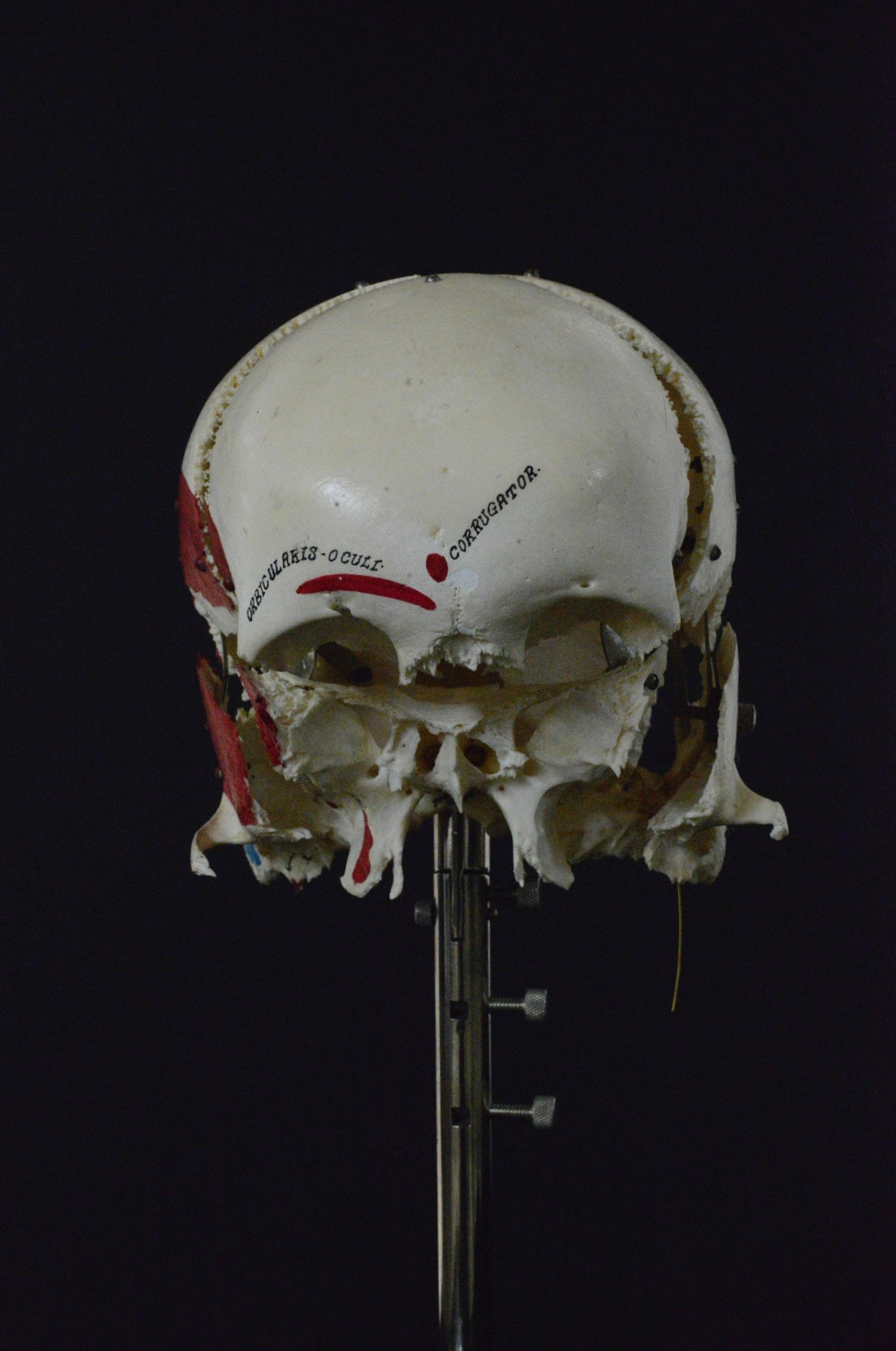 Authentic Exploding Skull: Beauchene Skull