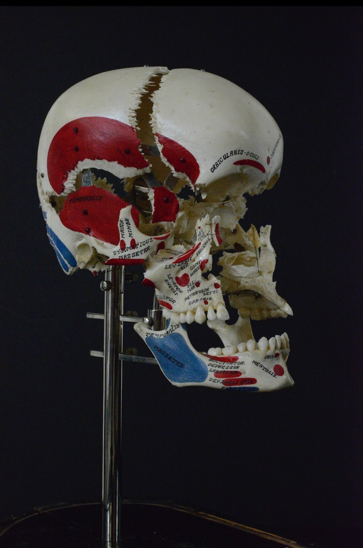 Authentic Exploding Skull: Beauchene Skull