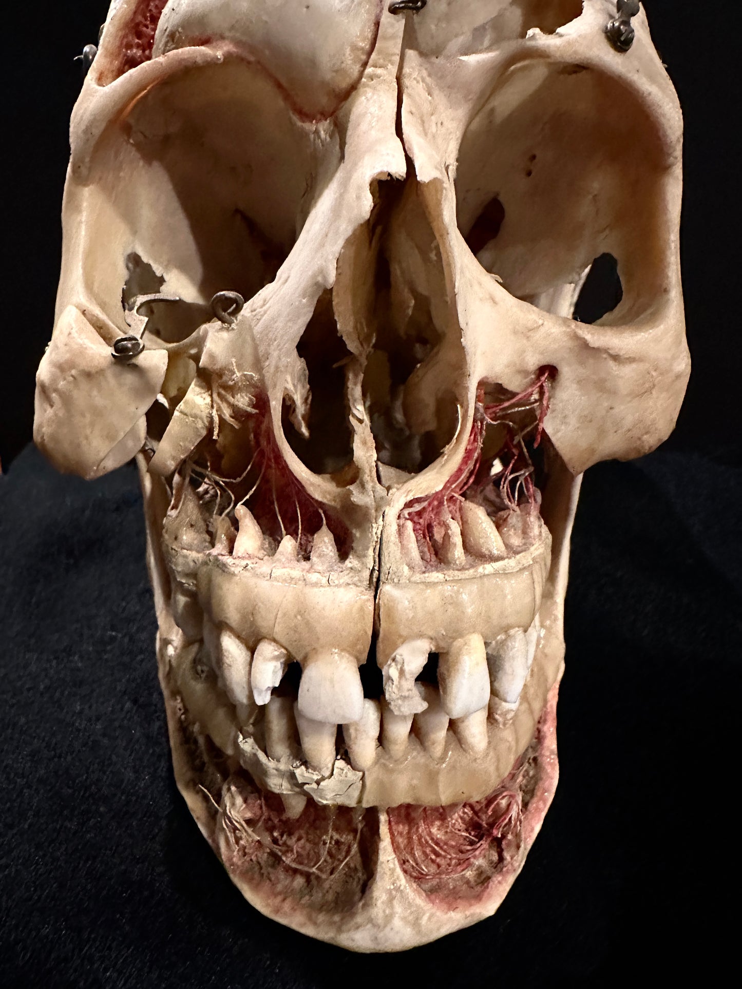 Authentic Human Skull Dissection