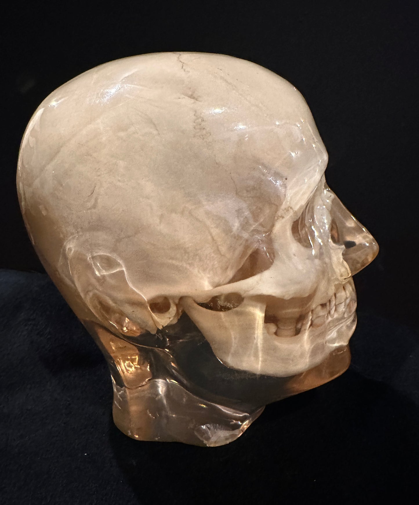 X-Ray Phantom Skull A