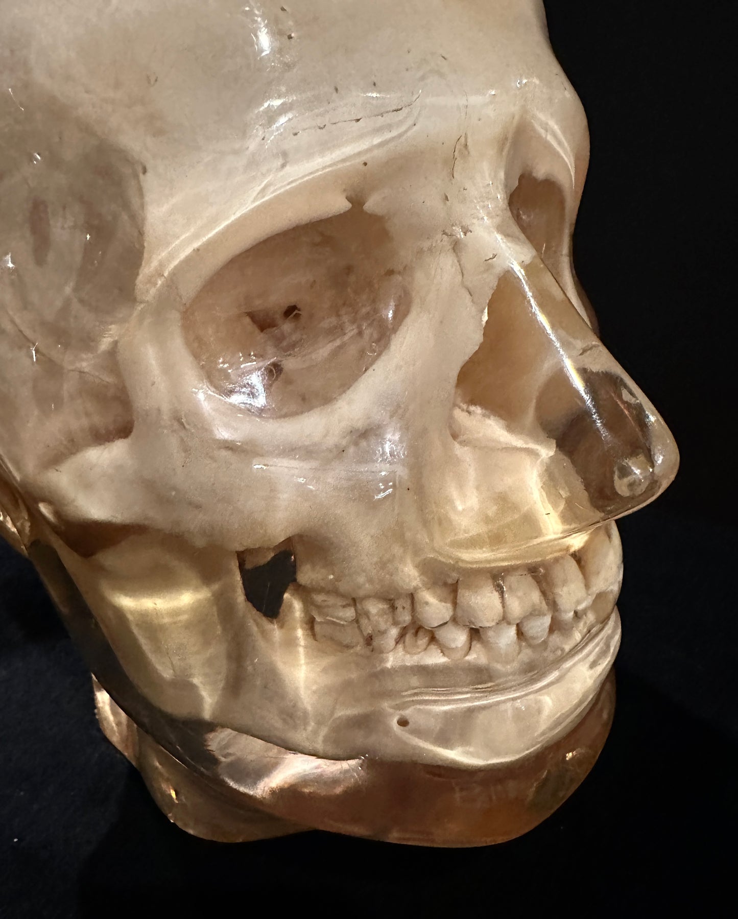 X-Ray Phantom Skull A