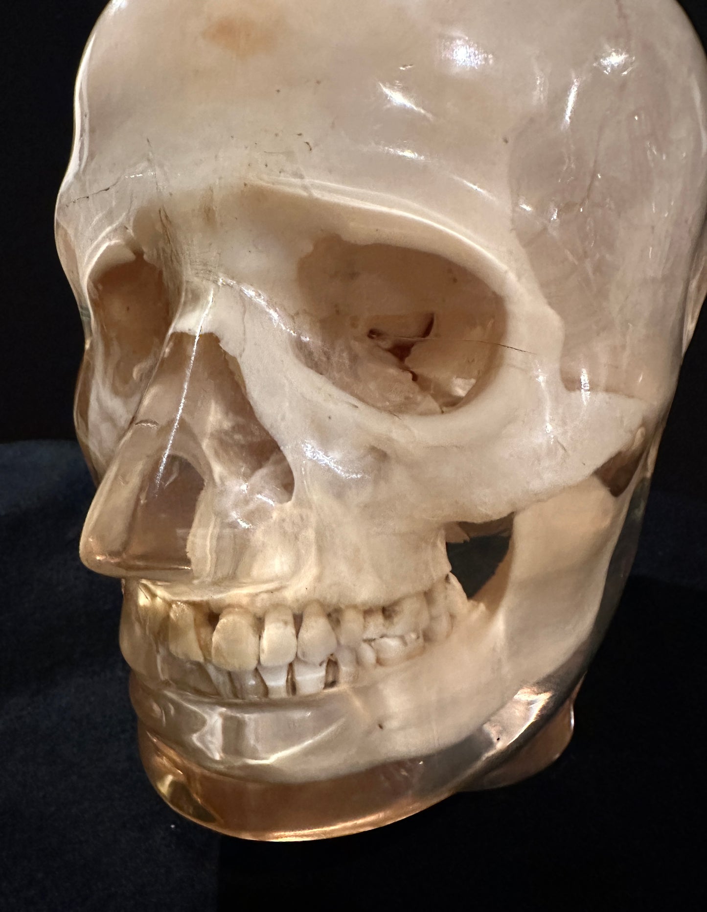 X-Ray Phantom Skull A