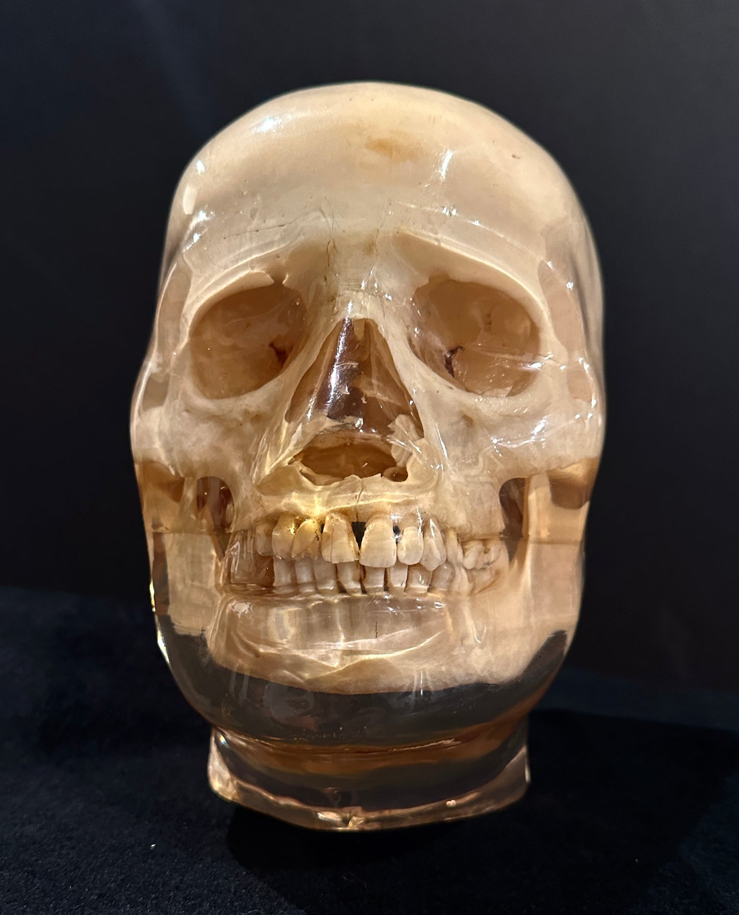 X-Ray Phantom Skull A