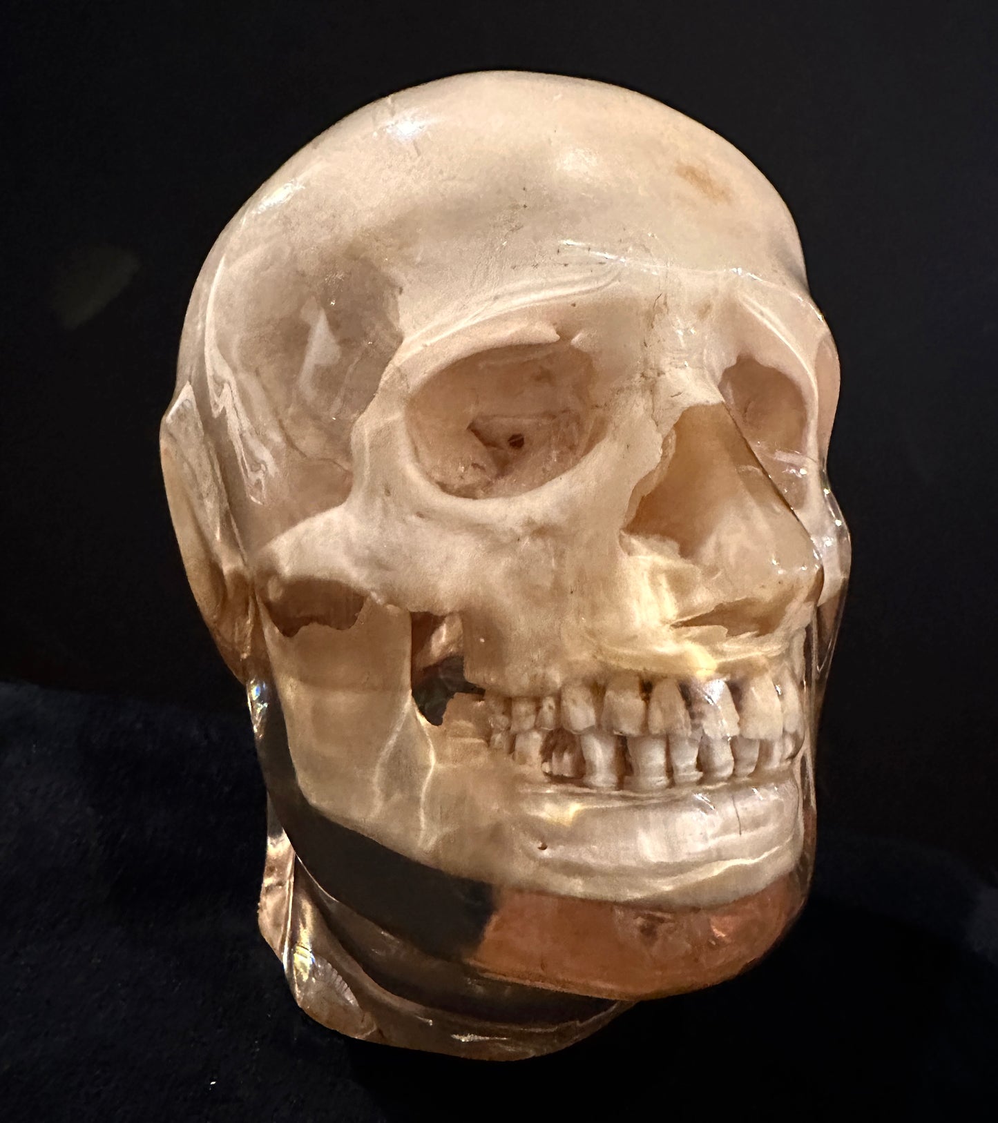 X-Ray Phantom Skull A