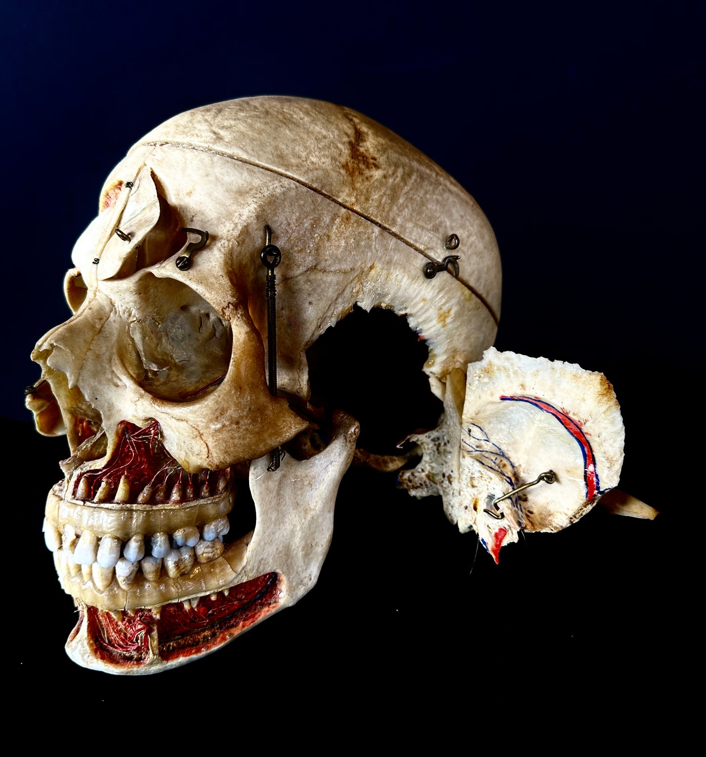 Authentic Human Skull Dissection