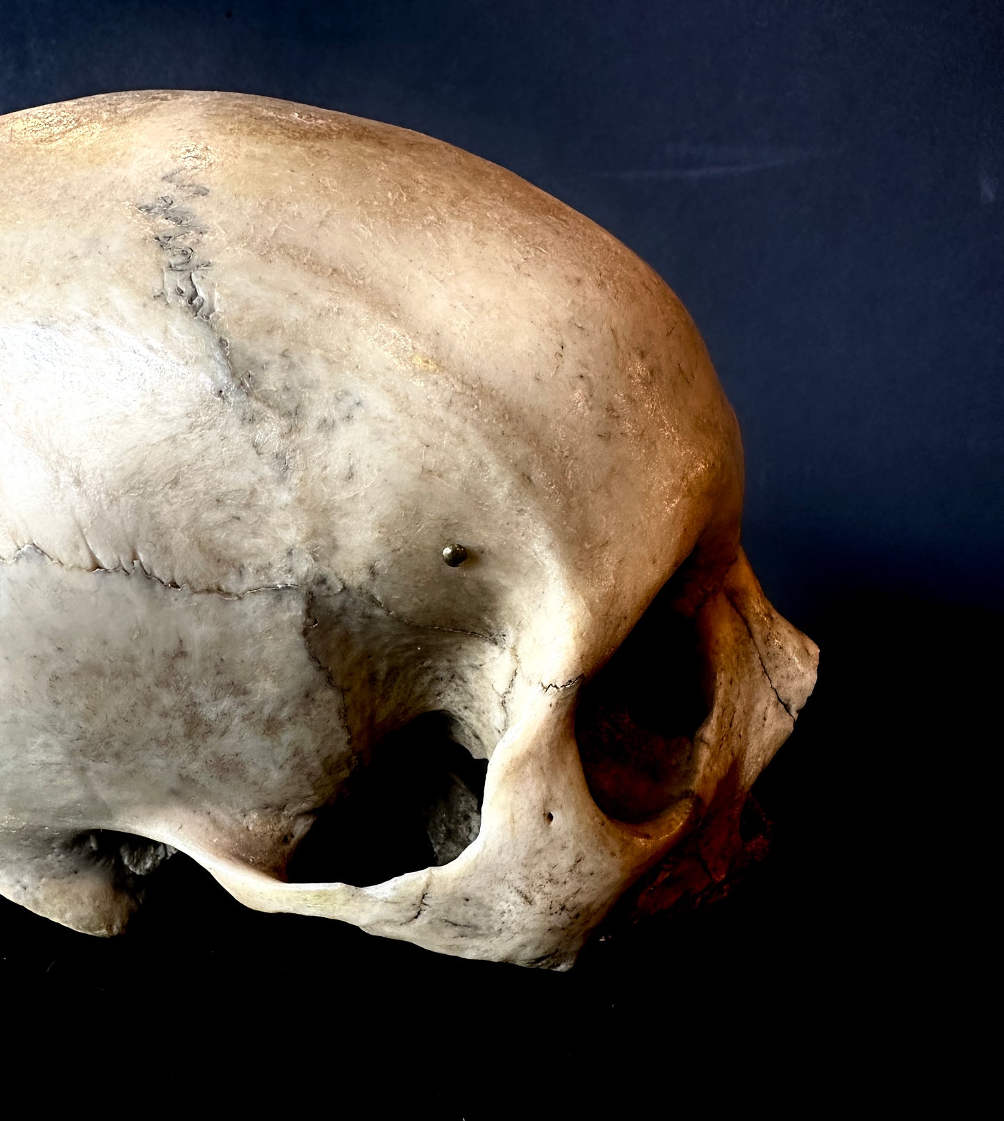 Uncut Skull : Slightly Elongated