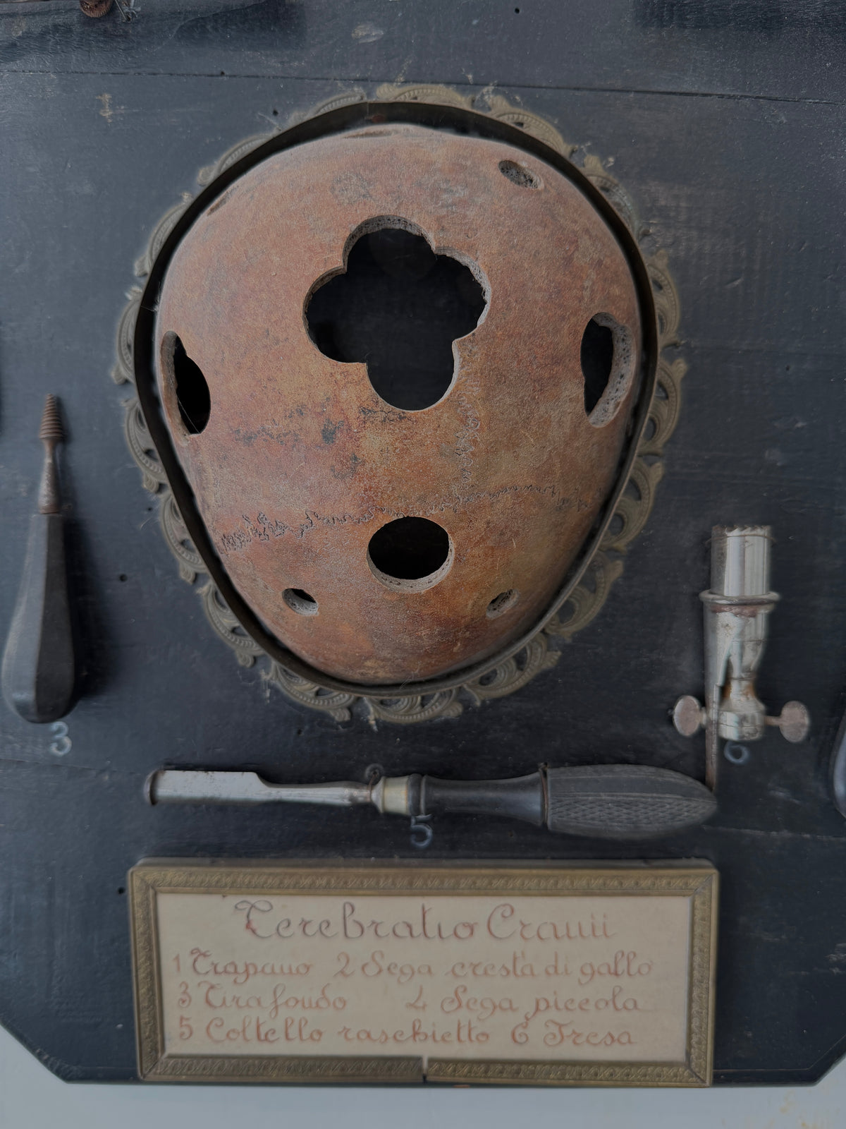 Italian "Terebratio Cranii" (Skull Trephining) Surgical Instrument Display Plaque