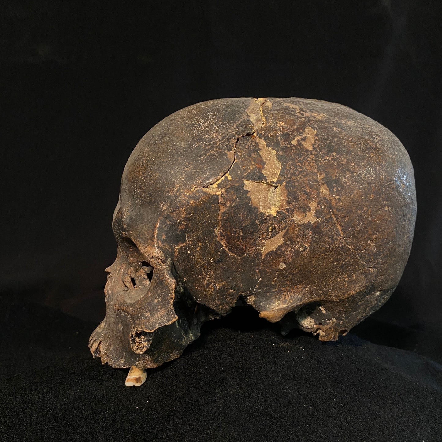 H_A12 Human Tribal Skull