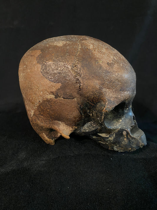 H_A16 Human Skull