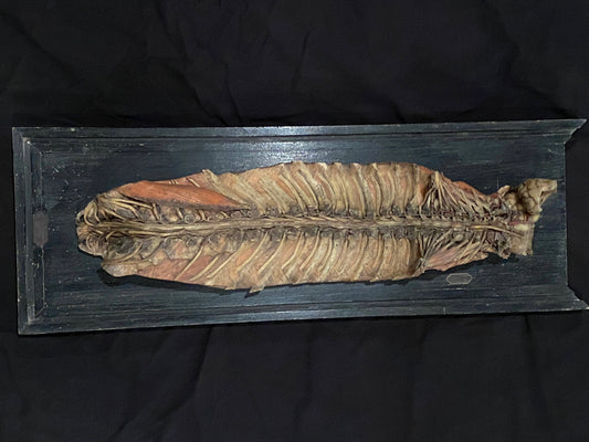 Tramond Wax Anatomical Model