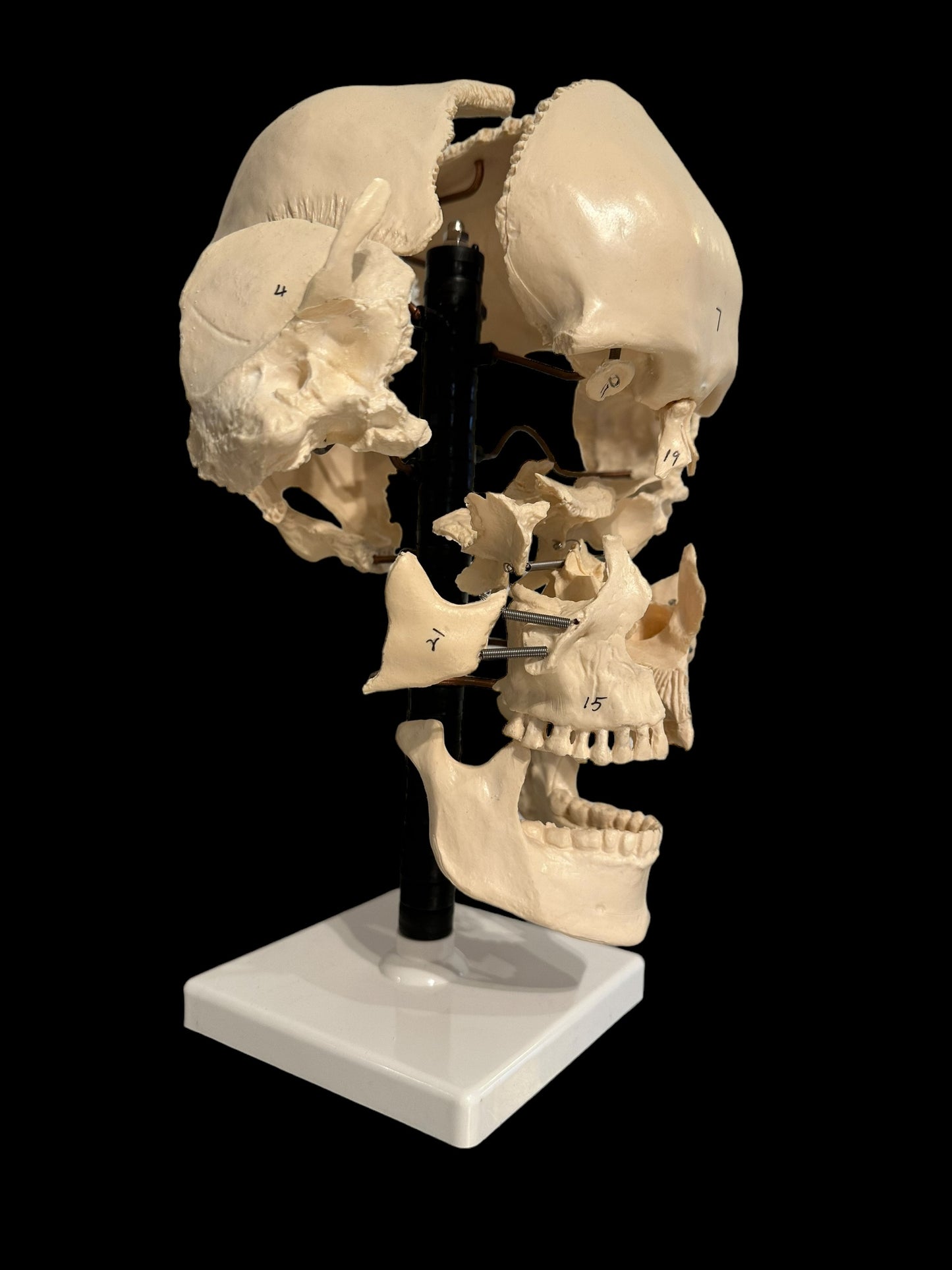 Exploding Skull: Beauchene Style