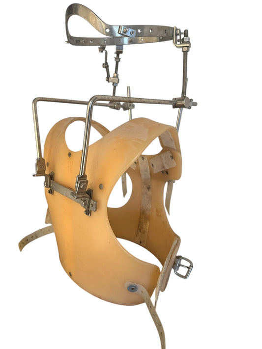 Halo-Gravity Traction: Treat Spinal Deformities