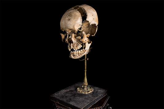Beauchene Human Exploding Skull