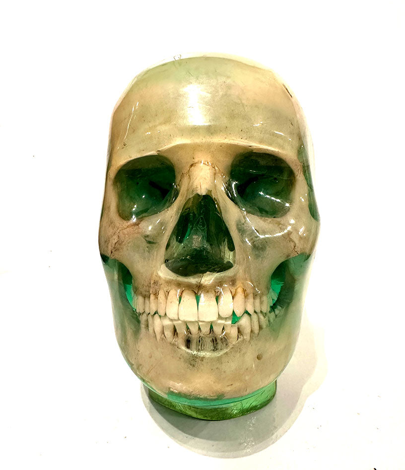 X-Ray Phantom Skull