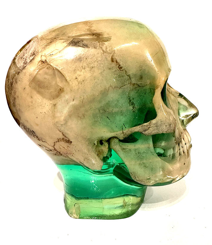 X-Ray Phantom Skull