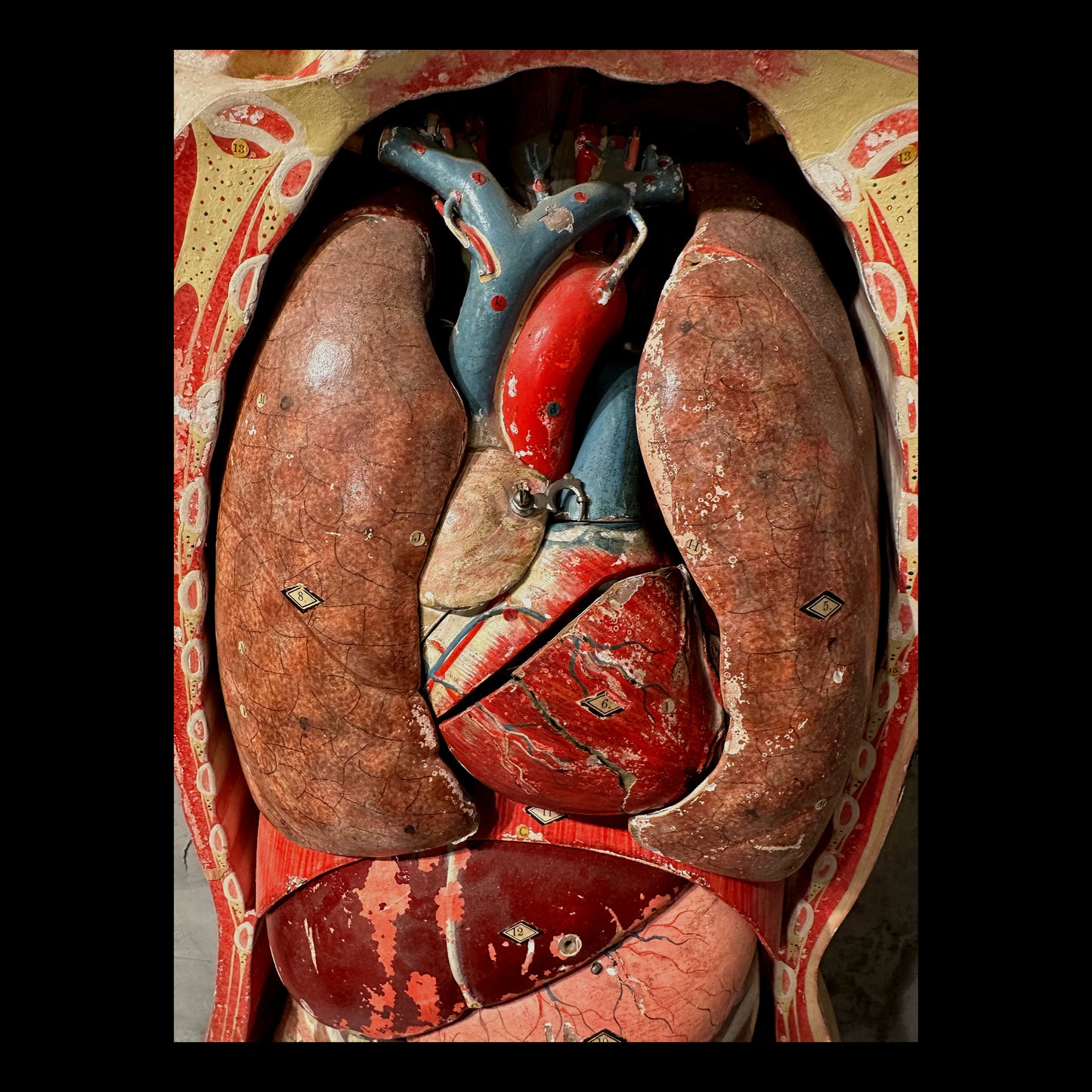 Clay Adams Anatomical Model