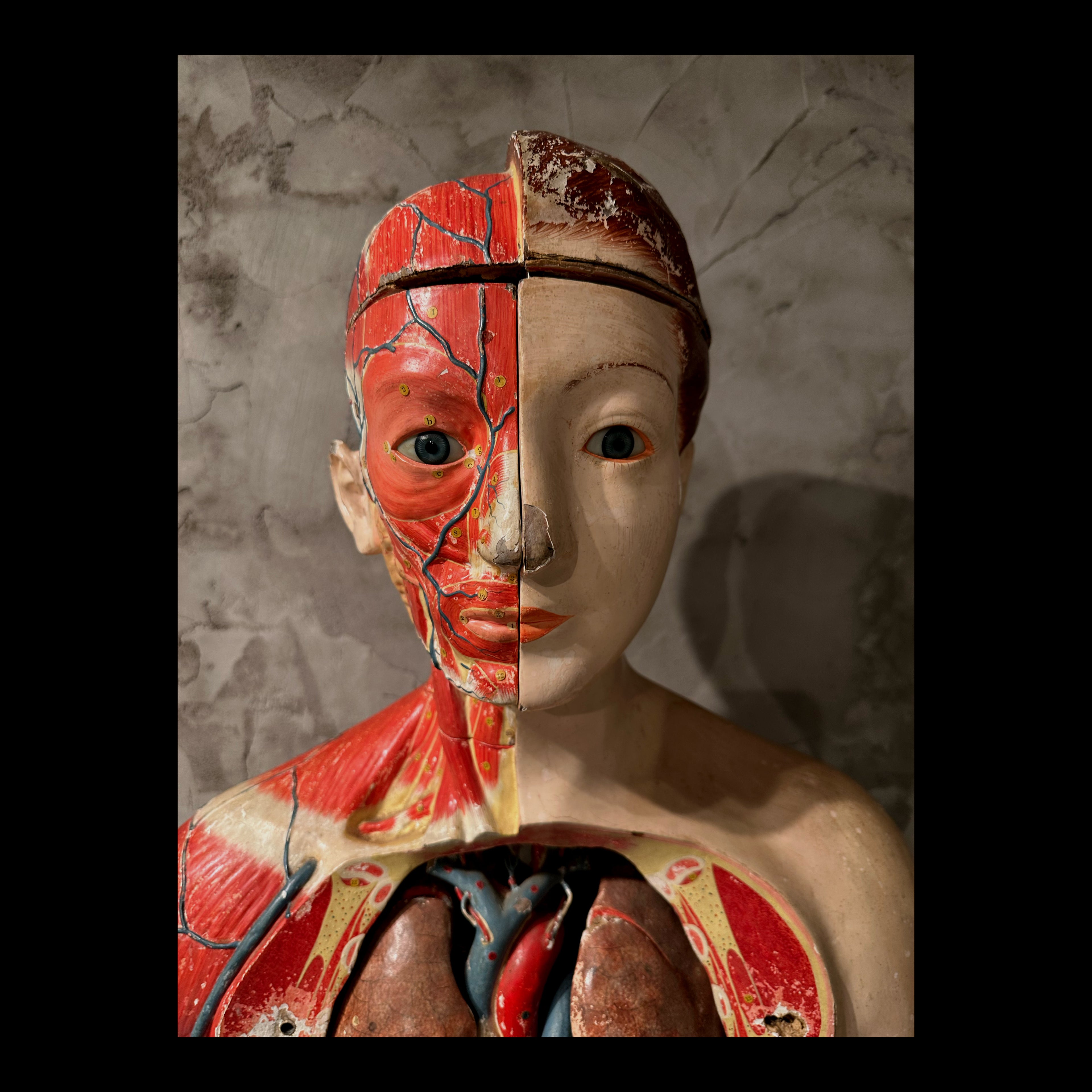 Anatomical model