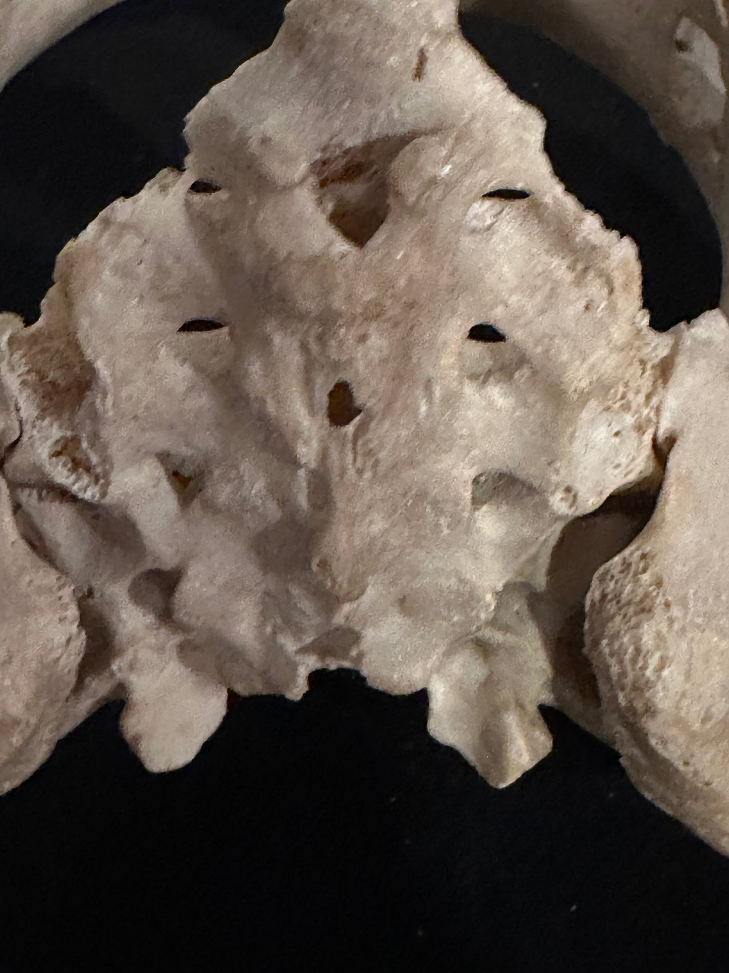 ARTERY LAB human pelvic model with sacrum, beige bone texture, anatomical detail.